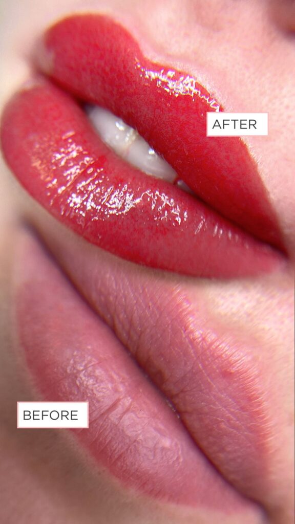 Before and after lip neutralization treatment showing even color correction