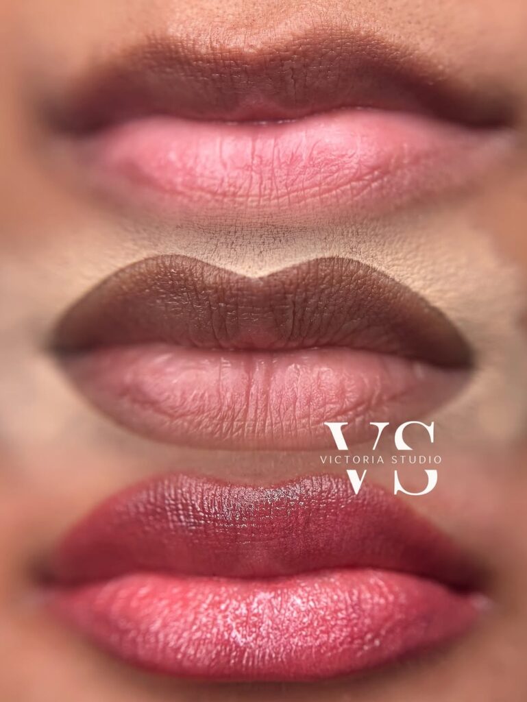 Before and after lip neutralization treatment showing even color correction