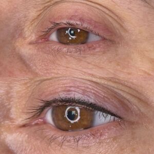 : lash line permanent makeup application Toronto – PMU device used for precise lash root pigment placement