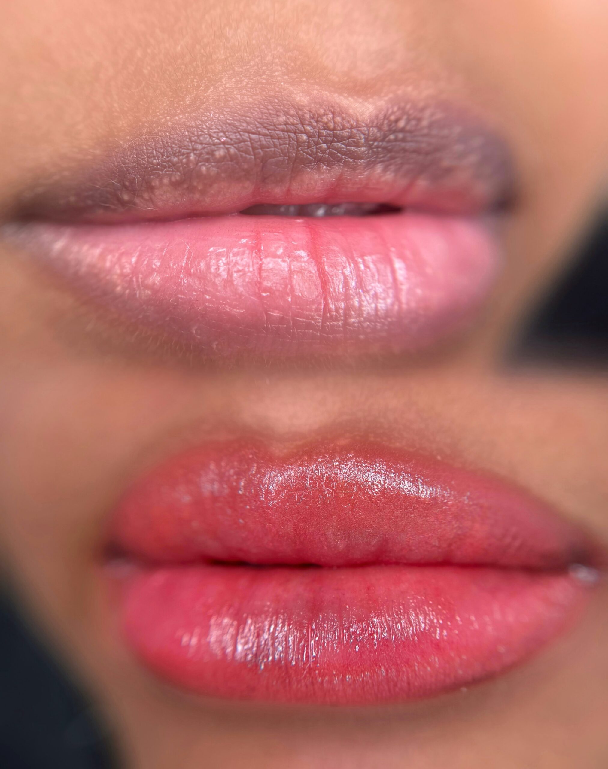 Lip neutralization for hyperpigmented lips at Victoria Studio Etobicoke