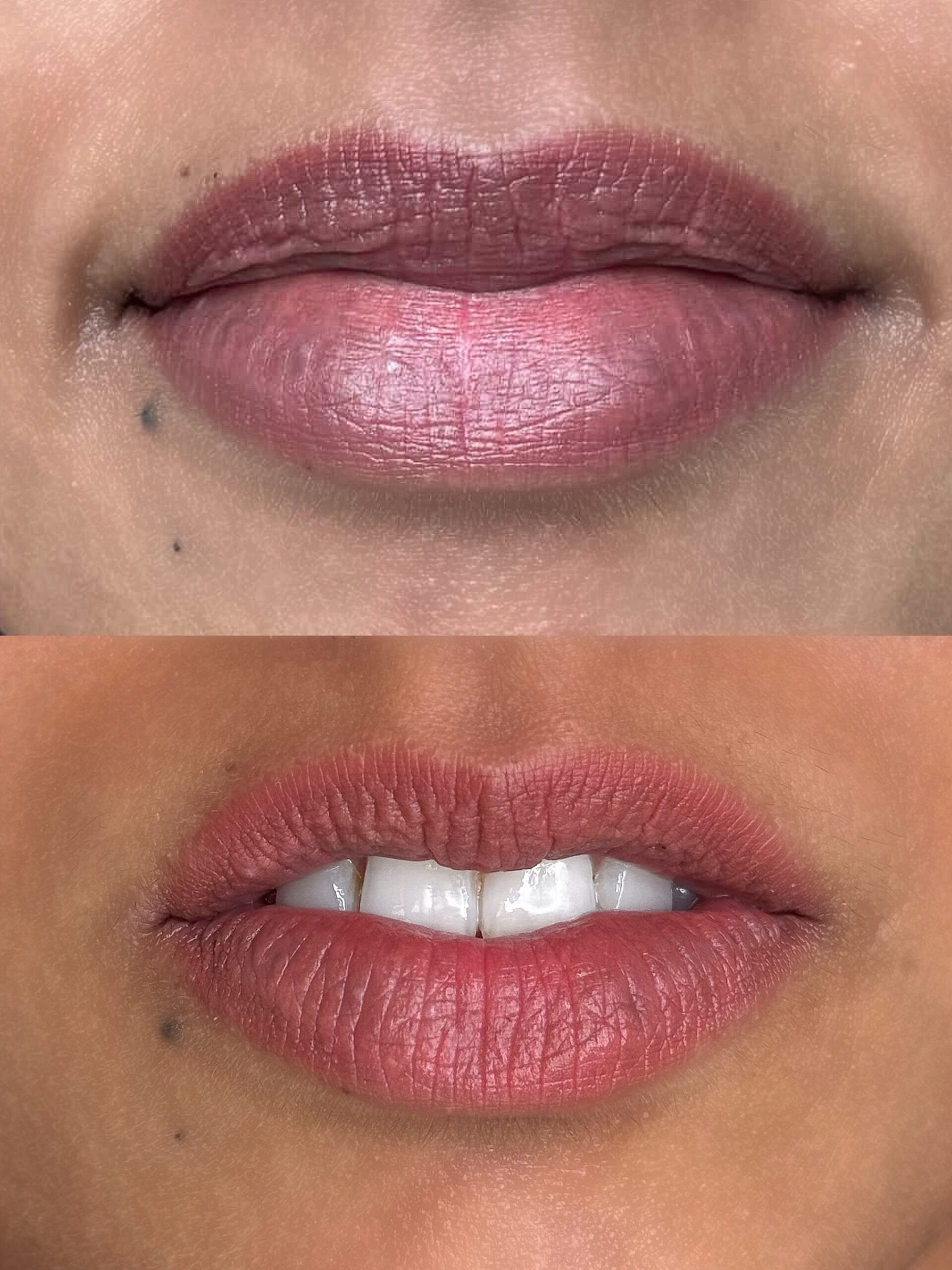 Victoria certified PMU artist performing lip neutralization in Etobicoke Toronto